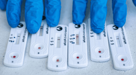 El informe semanal de la Covid-19 menciona la confirmación de casos mediante la prueba de RT-PCR. EL INFORMADOR / ARCHIVO
