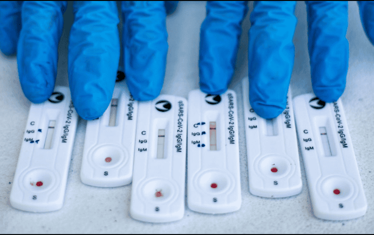 El informe semanal de la Covid-19 menciona la confirmación de casos mediante la prueba de RT-PCR. EL INFORMADOR / ARCHIVO